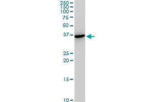 SNAI2 monoclonal antibody (M05), clone 3C12.