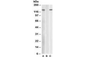 Western blot of HEK293 lysate overexpressing human NLRP2 with DYKDDDDK tag probed with NALP2 antibody [1ug/ml] in Lane A and probed with anti-DYKDDDDK tag [1/1000] in lane C.