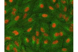 IF analysis of SAP130 using anti-SAP130 antibody (ABIN7601247) and anti-Tubulin Alpha antibody (ABIN7600339). (SAP130 anticorps  (AA 309-913))