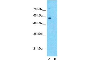 Host:  Rabbit  Target Name:  SLC6A2  Sample Type:  Human Fetal Lung  Lane A:  Primary Antibody  Lane B:  Primary Antibody + Blocking Peptide  Primary Antibody Concentration:  1ug/ml  Peptide Concentration:  5ug/ml  Lysate Quantity:  25ug/lane/lane  Gel Concentration:  0.