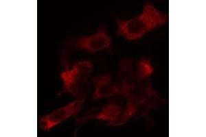 ABIN6266813 staining Hela cells by IF/ICC. (AGPAT9 anticorps  (Internal Region))