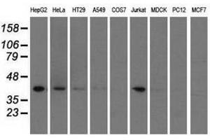 Image no. 3 for anti-3-hydroxyisobutyryl-CoA Hydrolase (HIBCH) antibody (ABIN1498656)