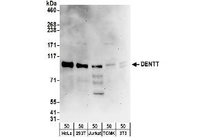 Western Blotting (WB) image for anti-TSPY-Like 2 (TSPYL2) (AA 1-50) antibody (ABIN7455002)