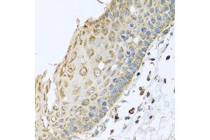 Immunohistochemistry of paraffin-embedded human esophagus using ARFGAP3 antibody at dilution of 1:100 (x40 lens). (ARFGAP3 anticorps)
