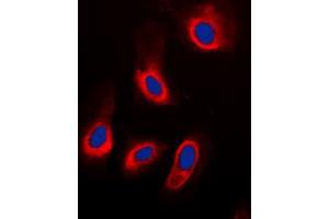 Immunofluorescent analysis of ADPGK staining in HeLa cells. (ADPGK anticorps  (Center))