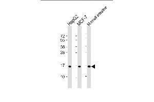 All lanes : Anti-COXIV Isoform 2 Antibody at 1:2000 dilution Lane 1: HepG2 whole cell lysate Lane 2: MCF-7 whole cell lysate Lane 3: mouse small intestine lysate Lysates/proteins at 20 μg per lane. (COX IV anticorps  (Isoform 2))