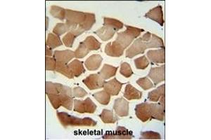 FLCN Antibody (C-term) (ABIN652601 and ABIN2842403) immunohistochemistry analysis in formalin fixed and paraffin embedded human skeletal muscle followed by peroxidase conjugation of the secondary antibody and DAB staining. (FLCN anticorps  (C-Term))