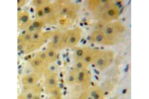 Used in DAB staining on fromalin fixed paraffin-embedded Liver tissue (HSPB2 anticorps  (AA 12-170))