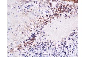 Formalin-fixed and paraffin embedded Human oral mucosa labeled with Anti-IL-6(human) Polyclonal Antibody, Unconjugated  at 1:200, followed by conjugation to the secondary antibody and DAB staining