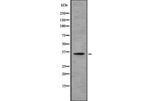Western blot analysis of ADORA2B using Jurkat whole cell lysates (Adenosine A2b Receptor anticorps  (Internal Region))