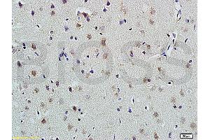 Formalin-fixed and paraffin embedded rat brain labeled with Anti-PLAUR Polyclonal Antibody, Unconjugated (ABIN675443) at 1:200 followed by conjugation to the secondary antibody and DAB staining
