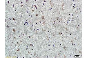 Formalin-fixed and paraffin embedded rat brain labeled with Anti-PLAUR Polyclonal Antibody, Unconjugated (ABIN675443) at 1:200 followed by conjugation to the secondary antibody and DAB staining (PLAUR anticorps  (AA 201-300))