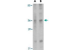 Western blot analysis of IL33 in human lymph node tissue lysate with IL33 polyclonal antibody  at (A) 1 and (B) 2 ug/mL . (IL-33 anticorps  (Internal Region))
