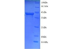 Ribosomal Protein S16 (RPS16) (AA 2-142), (partial) protein (GST tag) (RPS16 Protein (AA 2-142, partial) (GST tag))