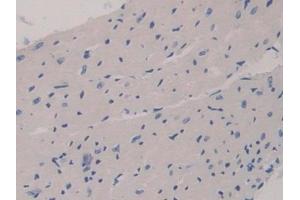 Detection of GAB3 in Mouse Heart Tissue using Polyclonal Antibody to GRB2 Associated Binding Protein 3 (GAB3)