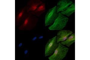 Phospho-STAT2 (Thr387) Antibody staining A549 cells(heat shock treatment) by IF/ICC.