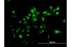 Immunofluorescence of purified MaxPab antibody to TRIM39 on HeLa cell. (TRIM39 anticorps  (AA 1-488))