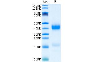 Human Azurocidin on Tris-Bis PAGE under reduced condition.