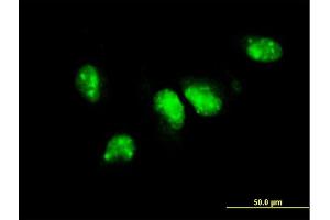 Immunofluorescence of monoclonal antibody to PIM1 on HeLa cell. (PIM1 anticorps  (AA 1-100))