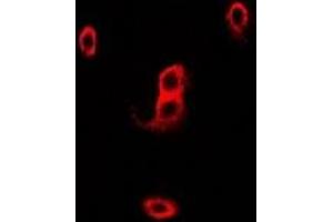 Immunofluorescent analysis of p67 phox staining in Hela cells. (NCF2 anticorps)