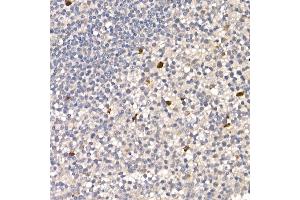 Immunohistochemistry of paraffin-embedded human tonsil using NUR77 Rabbit pAb (ABIN6132395, ABIN6144826, ABIN6144829 and ABIN6222380) at dilution of 1:100 (40x lens).