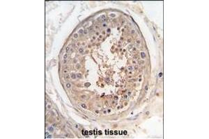 Formalin-fixed and raffin-embedded human testis tissue reacted with SG9 antibody (Center) (ABIN391447 and ABIN2841430) , which was peroxidase-conjugated to the secondary antibody, followed by DAB staining.