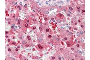 Human Liver (formalin-fixed, paraffin-embedded) stained with NDC80at 5 µg/ml followed by biotinylated anti-goat IgG secondary antibody, alkaline phosphatase-streptavidin and chromogen. (NDC80 anticorps  (C-Term))