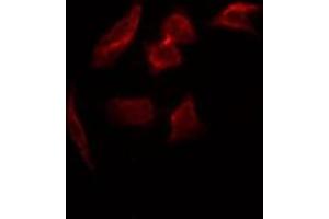 ABIN6267377 staining HepG2 by IF/ICC.