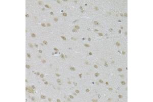 Immunohistochemistry of paraffin-embedded mouse brain using JMJD6 Antibody (ABIN5973452) at dilution of 1/100 (40x lens). (JMJD6 anticorps)