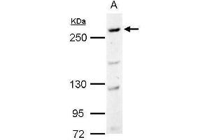 WB Image CAD antibody [C2C3], C-term detects CAD protein by Western blot analysis. (CAD anticorps  (C-Term))