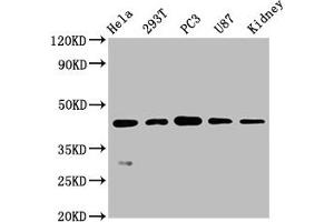 Western Blot Positive WB detected in: Hela whole cell lysate, 293T whole cell lysate, PC3 whole cell lysate, U87 whole cell lysate, Mouse kidney tissue All lanes: NDRG1 antibody at 0. (Recombinant NDRG1 anticorps)