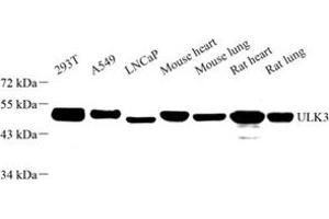 Western blot analysis of ULK3 (ABIN7076150) at dilution of 1: 1000 (ULK3 anticorps)