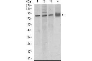 Western blot analysis using CDH5 mouse mAb against MCF-7 (1), A549 (2), HUVE-12 (3) cell lysate, and rat lung (4) tissue lysate. (Cadherin 5 anticorps  (AA 29-223))