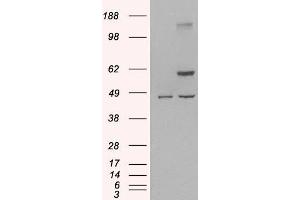 HEK293 overexpressing Human TRAF2 (ABIN5395543) and probed with ABIN190911 (mock transfection in first lane).