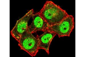 anti-TAR DNA Binding Protein (TARDBP) antibody