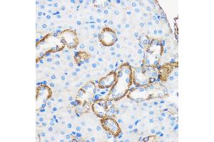 Immunohistochemistry of paraffin-embedded Mouse kidney using ApoM Rabbit pAb (ABIN6127365, ABIN6137030, ABIN6137031 and ABIN6220968) at dilution of 1:50 (40x lens).