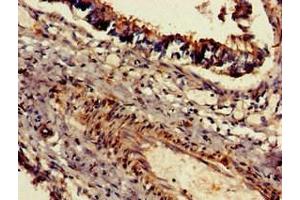 Immunohistochemistry of paraffin-embedded human lung tissue using ABIN7150873 at dilution of 1:100 (Dnah5 anticorps  (AA 2364-2560))