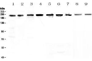 Western blot analysis of BRG1 using anti-BRG1 antibody . (SMARCA4 anticorps  (AA 555-763))