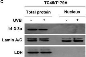 14-3-3σ transports TC45 into the keratinocyte nucleus following UVB irradiation through direct binding3PC keratinocytes overexpressing A.