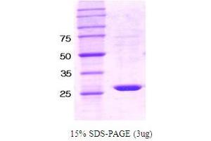SDS-PAGE (SDS) image for Protein-tyrosine Phosphatase 1C (PTPN6) protein (ABIN666674)