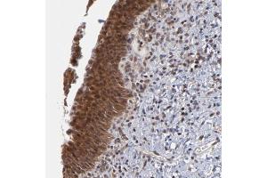 Immunohistochemical staining of human urinary bladder with UBE2L6 polyclonal antibody  shows strong cytoplasmic and nuclear positivity in urothelial cells at 1:50-1:200 dilution.
