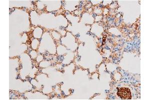 ABIN6267576 at 1/200 staining Mouse lung tissue sections by IHC-P. (Smad2/3 anticorps  (pThr8, Thr8))