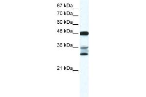 WB Suggested Anti-TNFSF10 Antibody Titration:  0.