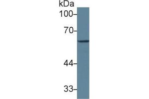 Detection of GAD1 in Mouse Cerebrum lysate using Polyclonal Antibody to Glutamate Decarboxylase 1, Brain (GAD1) (GAD anticorps  (AA 1-97))