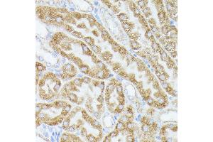 Immunohistochemistry of paraffin-embedded mouse kidney using  antibody (ABIN6131166, ABIN6136417, ABIN6136418 and ABIN6223845) at dilution of 1:100 (40x lens). (ACAT2 anticorps  (AA 1-97))
