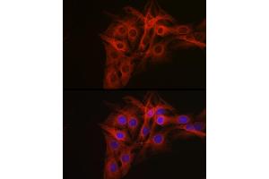 Immunofluorescence analysis of C6 cells using β-Tubulin Rabbit pAb (ABIN3020552, ABIN3020553 and ABIN3020554) at dilution of 1:100 (40x lens). (TUBB anticorps  (AA 40-260))