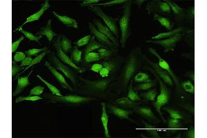 Immunofluorescence of purified MaxPab antibody to CALCOCO1 on HeLa cell.