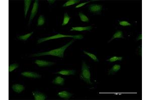 Immunofluorescence of purified MaxPab antibody to PIN4 on HeLa cell. (PIN4 anticorps  (AA 1-156))