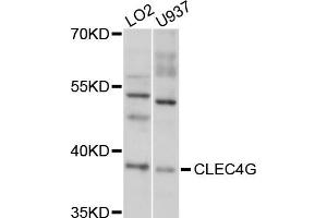 Western blot analysis of extracts of LO2 and U937 cells, using CLEC4G antibody. (CLEC4G anticorps)