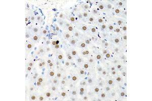 Immunohistochemistry of paraffin-embedded rat liver using PTBP1 antibody.